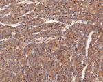 alpha Actinin Antibody in Immunohistochemistry (Paraffin) (IHC (P))