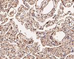 alpha Actinin Antibody in Immunohistochemistry (Paraffin) (IHC (P))