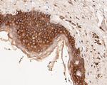 alpha Actinin Antibody in Immunohistochemistry (Paraffin) (IHC (P))