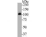 alpha Actinin Antibody in Western Blot (WB)