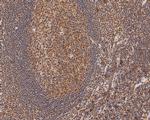 RUVBL2 Antibody in Immunohistochemistry (Paraffin) (IHC (P))