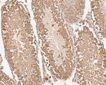 RUVBL2 Antibody in Immunohistochemistry (Paraffin) (IHC (P))