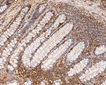 RUVBL2 Antibody in Immunohistochemistry (Paraffin) (IHC (P))