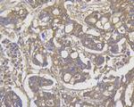 ROBO1 Antibody in Immunohistochemistry (Paraffin) (IHC (P))