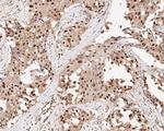 MTA2 Antibody in Immunohistochemistry (Paraffin) (IHC (P))