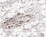 MTA2 Antibody in Immunohistochemistry (Paraffin) (IHC (P))