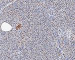 MTA2 Antibody in Immunohistochemistry (Paraffin) (IHC (P))