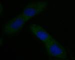 CAPZA1 Antibody in Immunocytochemistry (ICC/IF)