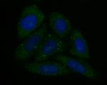 CAPZA1 Antibody in Immunocytochemistry (ICC/IF)