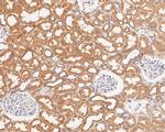 CAPZA1 Antibody in Immunohistochemistry (Paraffin) (IHC (P))