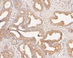 CAPZA1 Antibody in Immunohistochemistry (Paraffin) (IHC (P))