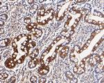 Cytokeratin 20 Antibody in Immunohistochemistry (Paraffin) (IHC (P))