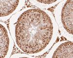 RAP80 Antibody in Immunohistochemistry (Paraffin) (IHC (P))