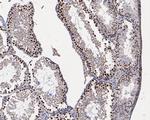 HMGB2 Antibody in Immunohistochemistry (Paraffin) (IHC (P))