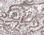 HMGB2 Antibody in Immunohistochemistry (Paraffin) (IHC (P))