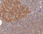 CASK Antibody in Immunohistochemistry (Paraffin) (IHC (P))