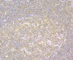 CHI3L1 Antibody in Immunohistochemistry (Paraffin) (IHC (P))