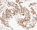 NuMA Antibody in Immunohistochemistry (Paraffin) (IHC (P))