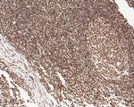 NuMA Antibody in Immunohistochemistry (Paraffin) (IHC (P))