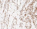 NuMA Antibody in Immunohistochemistry (Paraffin) (IHC (P))