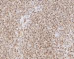 NuMA Antibody in Immunohistochemistry (Paraffin) (IHC (P))