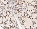 NuMA Antibody in Immunohistochemistry (Paraffin) (IHC (P))