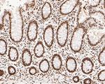 NuMA Antibody in Immunohistochemistry (Paraffin) (IHC (P))