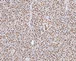 NuMA Antibody in Immunohistochemistry (Paraffin) (IHC (P))