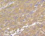 DAPK1 Antibody in Immunohistochemistry (Paraffin) (IHC (P))