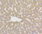 DAPK1 Antibody in Immunohistochemistry (Paraffin) (IHC (P))