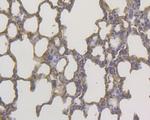 DAPK1 Antibody in Immunohistochemistry (Paraffin) (IHC (P))