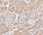 FBP1 Antibody in Immunohistochemistry (Paraffin) (IHC (P))