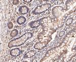 FBP1 Antibody in Immunohistochemistry (Paraffin) (IHC (P))