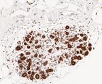 PSMD14 Antibody in Immunohistochemistry (Paraffin) (IHC (P))