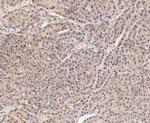 PSMD14 Antibody in Immunohistochemistry (Paraffin) (IHC (P))