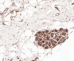 PRKAR2A Antibody in Immunohistochemistry (Paraffin) (IHC (P))