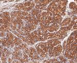 PRKAR2A Antibody in Immunohistochemistry (Paraffin) (IHC (P))