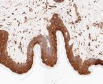 PRKAR2A Antibody in Immunohistochemistry (Paraffin) (IHC (P))