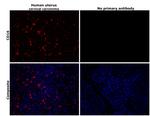 CD16 Antibody in Immunohistochemistry (Paraffin) (IHC (P))