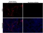 CD16 Antibody in Immunohistochemistry (Paraffin) (IHC (P))