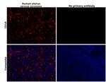 CD16 Antibody in Immunohistochemistry (Paraffin) (IHC (P))