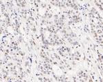 EHMT2 Antibody in Immunohistochemistry (Paraffin) (IHC (P))