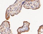 Phospho-ErbB3 (Tyr1222) Antibody in Immunohistochemistry (Paraffin) (IHC (P))