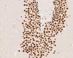 NeuroD2 Antibody in Immunohistochemistry (Paraffin) (IHC (P))