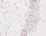 NeuroD2 Antibody in Immunohistochemistry (Paraffin) (IHC (P))