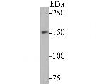 WRN Antibody in Western Blot (WB)