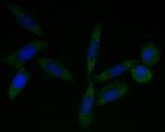 Tropomodulin 2 Antibody in Immunocytochemistry (ICC/IF)