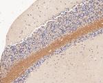 Tropomodulin 2 Antibody in Immunohistochemistry (Paraffin) (IHC (P))