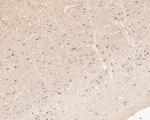 Tropomodulin 2 Antibody in Immunohistochemistry (Paraffin) (IHC (P))