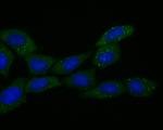 ECM1 Antibody in Immunocytochemistry (ICC/IF)